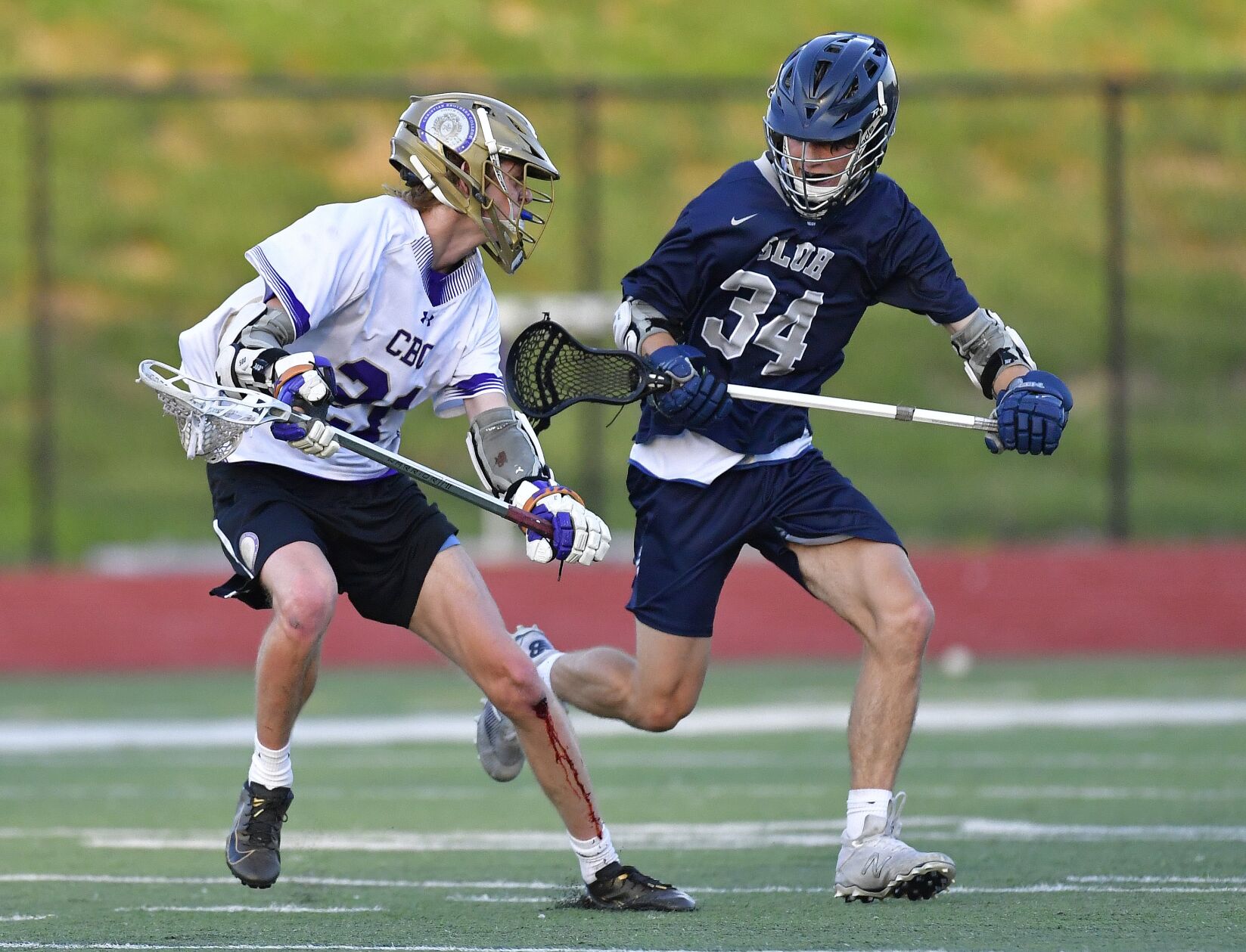 SLUH vs CBC